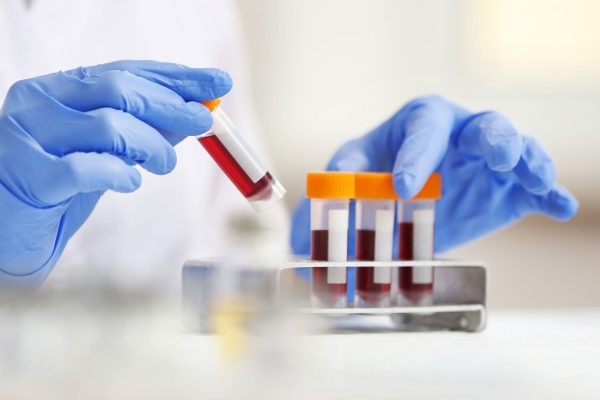 CMC & Quality (Drug Substance & Drug Product)